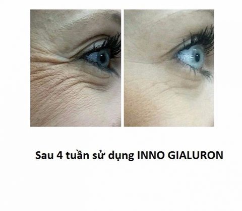 mai-tre-dep-cung-serum-inno-gialuron-1m4G3-tlWOtR_simg_d0daf0_800x1200_max
